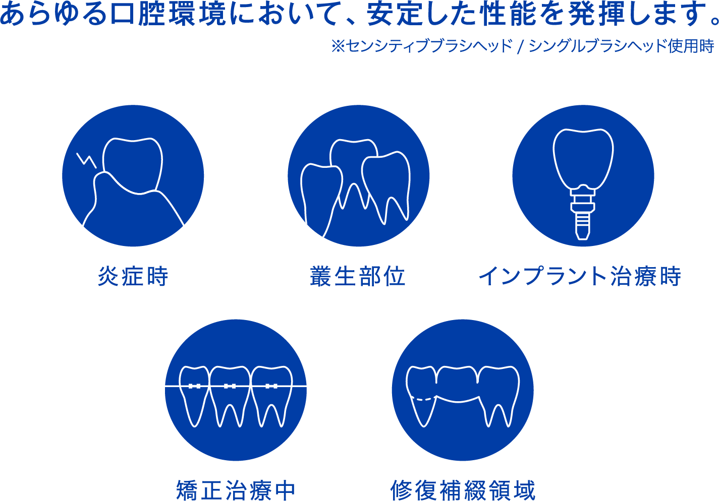 あらゆる口腔環境において、安定した性能を発揮します。※センシティブブラシヘッド/シングルブラシヘッド使用時。炎症時　叢生部位　インプラント治療時　矯正治療中　修復補綴領域
